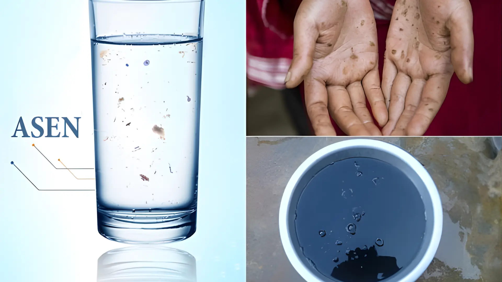 Tiếp xúc với arsen qua nước uống có thể gây ra cả tác động cấp tính