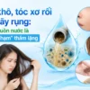 Nguồn nước: Thủ phạm gây khô tóc, rụng tóc và khô da